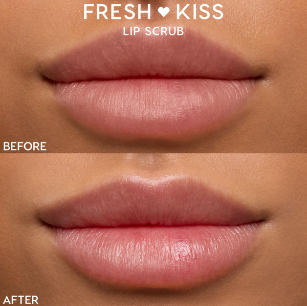 Close-up lips showcase a before-and-after using ColourPop Lip Scrub, Vanilla Cake (Fresh Kiss): before looks dry and flaky, after appears smoother, softer, and glossy, highlighting exfoliation and hydration results on a neutral-toned face.