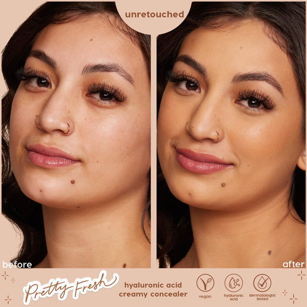 Model’s face shows before-and-after coverage using ColourPop Pretty Fresh Creamy Concealer in Medium 83 C, evening skin tone and softening dark spots; unretouched side-by-side close-up with icons for hyaluronic acid, vegan, dermatologist tested.