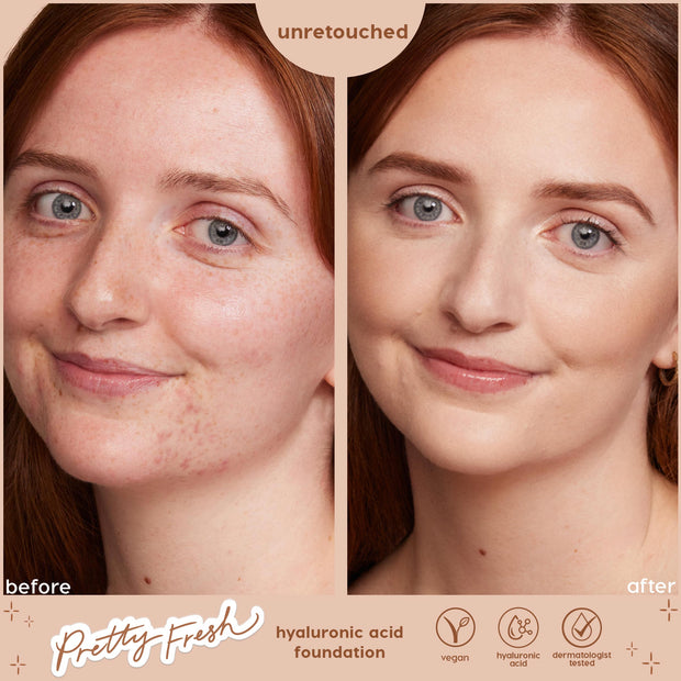 ColourPop Hyaluronic Hydrating Foundation in Fair 20 N evens skin tone on a model's face in an unretouched before-and-after, side-by-side studio close-up showing reduced redness and a natural finish; Pretty Fresh, vegan, hyaluronic acid, dermatologist tested.