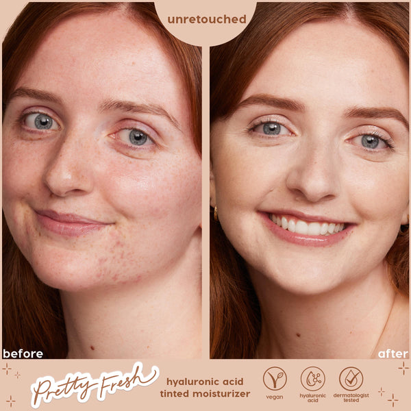 Side-by-side before-and-after close-up shows ColourPop Pretty Fresh Tinted Moisturizer, shade Fair 1 N with concealer, evening facial redness and freckles into a smoother, radiant finish; unretouched label and icons highlight hyaluronic acid, vegan, dermatologist tested.