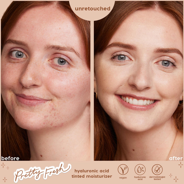 Side-by-side before-and-after close-up shows ColourPop Pretty Fresh Tinted Moisturizer, shade Fair 1 N with concealer, evening facial redness and freckles into a smoother, radiant finish; unretouched label and icons highlight hyaluronic acid, vegan, dermatologist tested.