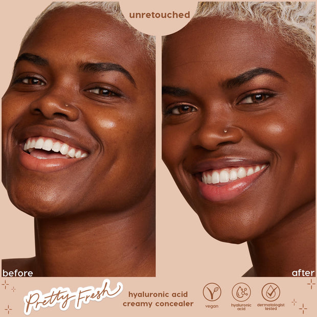 Deep Dark 200 N Pretty Fresh Creamy Concealer evening tone and softening dark circles on a smiling model; side-by-side before and after shows a natural, unretouched finish; ColourPop Pretty Fresh Creamy Concealer with hyaluronic acid.